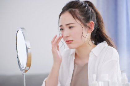 ニキビ（尋常性ざ瘡）